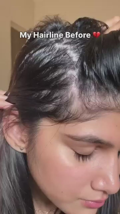 Rosemary Hair Growth Serum (Roll On) 25ml